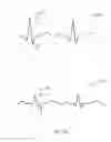 Fig. 49 - Methods of determining catheter orientation