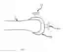 Fig. 07 - ALIGNMENT DEVICE