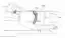 Fig. 01 - Device to detect and treat apneas and hypopnea