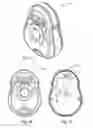 Fig. 03 - BREASTFEEDING QUANTITY ESTIMATOR