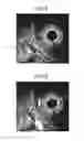 Fig. 07 - Ultrasound observation device, processing device, method of operating ultrasound observation device, and computer readable recording medium
