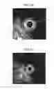 Fig. 08 - Ultrasound observation device, processing device, method of operating ultrasound observation device, and computer readable recording medium