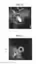 Fig. 09 - Ultrasound observation device, processing device, method of operating ultrasound observation device, and computer readable recording medium