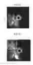 Fig. 10 - Ultrasound observation device, processing device, method of operating ultrasound observation device, and computer readable recording medium
