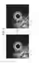 Fig. 12 - Ultrasound observation device, processing device, method of operating ultrasound observation device, and computer readable recording medium