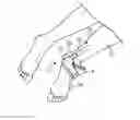Fig. 01 - Apparatus and methods for Achilles tendon repair