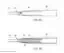 Fig. 06 - Apparatus and methods for Achilles tendon repair