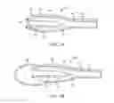 Fig. 07 - Apparatus and methods for Achilles tendon repair