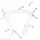 Fig. 01 - STAPLES FOR GENERATING AND APPLYING COMPRESSION WITHIN A BODY
