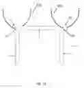 Fig. 28 - STAPLES FOR GENERATING AND APPLYING COMPRESSION WITHIN A BODY