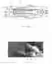 Fig. 22 - Applicator instruments for dispensing surgical fasteners having articulating shafts and articulation control elements