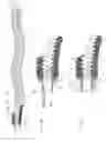 Fig. 03 - Packaging for surgical implant