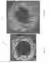 Fig. 23 - Packaging for surgical implant