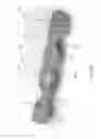 Fig. 33 - Packaging for surgical implant