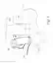 Fig. 07 - Patient specific instruments and methods for joint prosthesis
