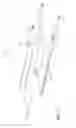 Fig. 14 - Patient specific instruments and methods for joint prosthesis