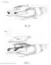 Fig. 09 - Surgical Micro-Shears and Methods of Fabrication and Use