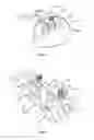 Fig. 04 - Surgical implant bending system and method