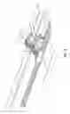 Fig. 09 - Surgical implant bending system and method