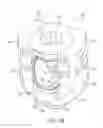 Fig. 03 - Bone attachment assembly