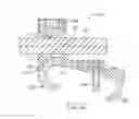 Fig. 16 - Bone attachment assembly