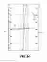 Fig. 49 - Bone stabilization systems