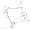 Fig. 02 - Bone screw and instruments for probing position of bone screw