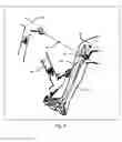 Fig. 07 - Method and system for computer assisted surgery