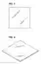 Fig. 02 - Advanced Orthodontic Retainer
