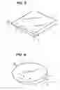 Fig. 04 - Advanced Orthodontic Retainer