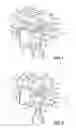 Fig. 02 - COATED ORTHODONTIC APPLIANCES AND METHODS OF MAKING SAME