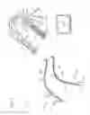 Fig. 06 - Systems, devices, and methods for organ retroperfusion along with regional mild hypothermia