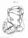 Fig. 07 - Systems, devices, and methods for organ retroperfusion along with regional mild hypothermia