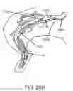 Fig. 28 - Systems, devices, and methods for organ retroperfusion along with regional mild hypothermia