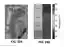 Fig. 32 - Systems, devices, and methods for organ retroperfusion along with regional mild hypothermia