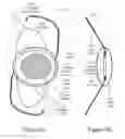 Fig. 03 - Electro-chromic ophthalmic devices