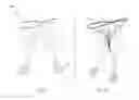 Fig. 02 - Naturally designed mitral prosthesis