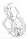 Fig. 01 - Positioning, deploying, and retrieving implantable devices