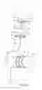 Fig. 05 - Sizing catheters, methods of sizing complex anatomies and methods of selecting a prosthesis for implantation