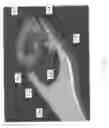 Fig. 08 - Decoupled spacer and plate and method of installing the same