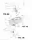 Fig. 04 - Intervertebral spacer and plate