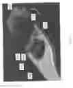 Fig. 07 - Decoupled spacer and plate and method of installing the same