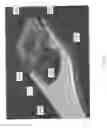 Fig. 08 - Decoupled spacer and plate and method of installing the same