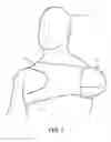 Fig. 02 - GYROSCOPICALLY CONTROLLED BALANCE PROSTHETIC