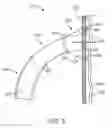 Fig. 06 - Delivery system for anchor and method