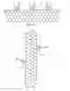 Fig. 02 - Apparatus and method for deploying an implantable device within the body