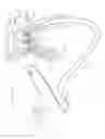 Fig. 35 - Apparatus and method for deploying an implantable device within the body