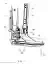 Fig. 02 - Brace and insertion-fitting member used therefore
