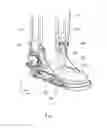 Fig. 02 - BRACE AND INSERTION-FITTING MEMBER USED THEREFORE