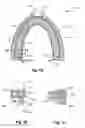 Fig. 02 - Breathing assist device